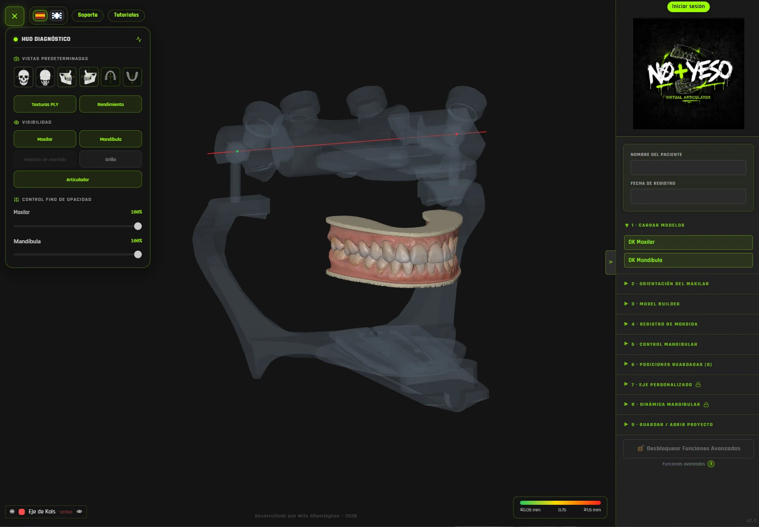 Montaje de modelos STL en el articulador virtual NO+YESO con eje de Kois y geometría de referencia