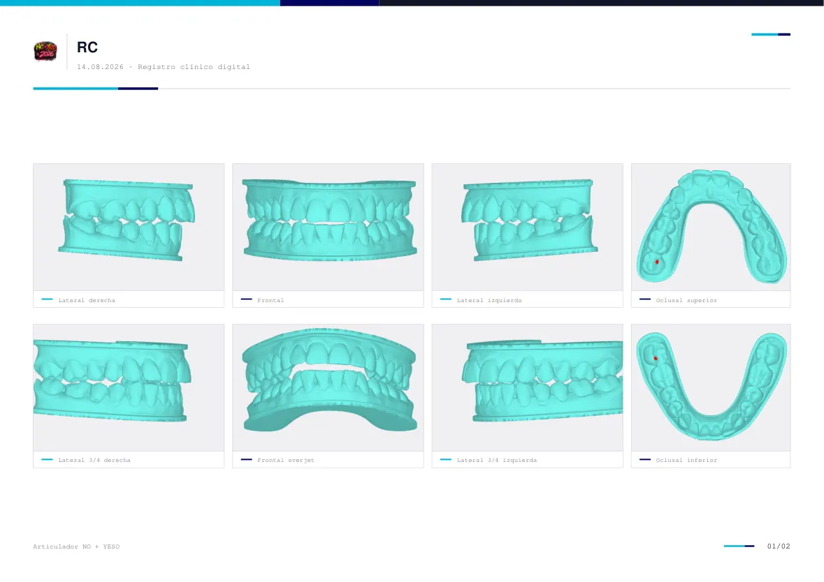 Informe de posiciones del articulador virtual: ocho vistas clínicas del montaje 3D