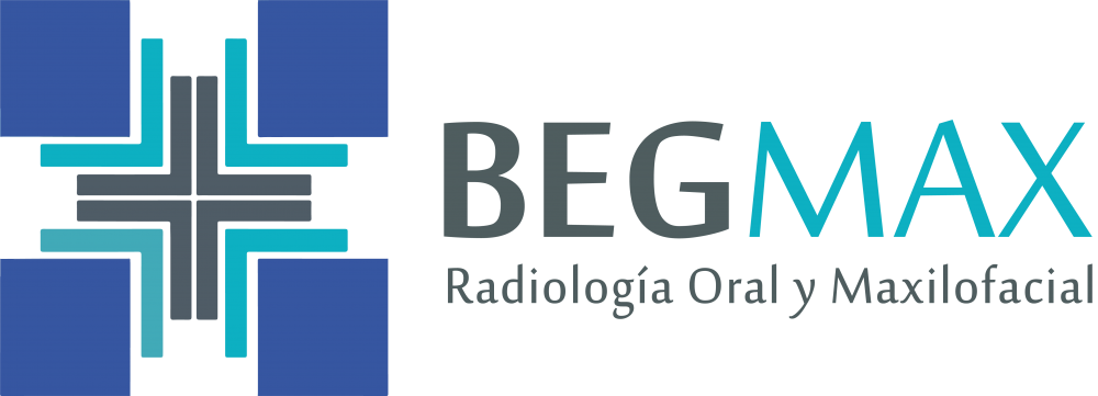Begmax